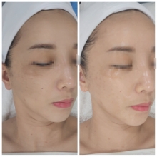 헤이븐 에스테틱